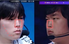 【沙巴娱乐】网友细扒Bin脸部变化细节：鼻梁变直变长；脸颊软组织折叠变化
